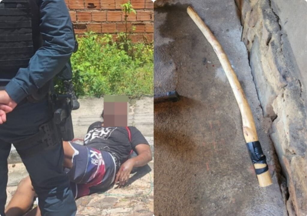 Mulher sofre fraturas após agressão brutal em Parnaíba