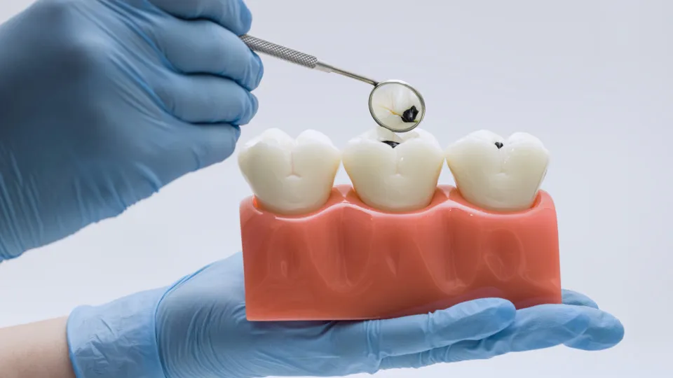 Alimentos comuns podem danificar o esmalte dos dentes; saiba mais