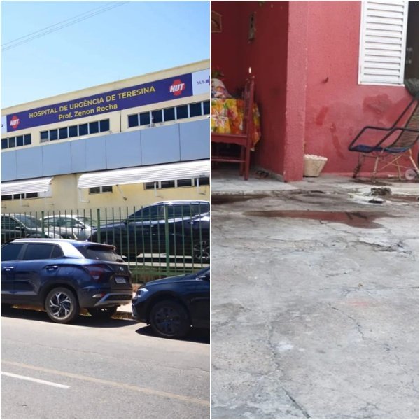 Mulher que sofreu queimaduras graves morre em hospital de Teresina; mãe continua internada