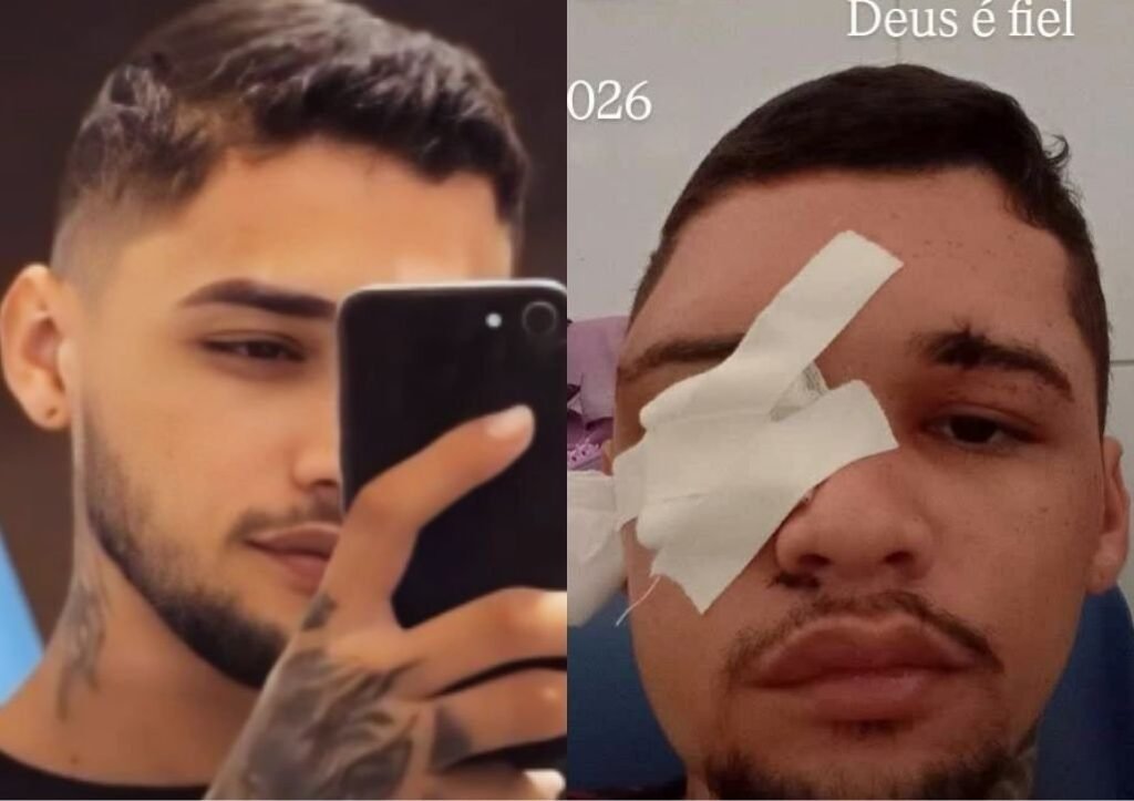 Jovem é baleado duas vezes na cabeça após confusão em Teresina
