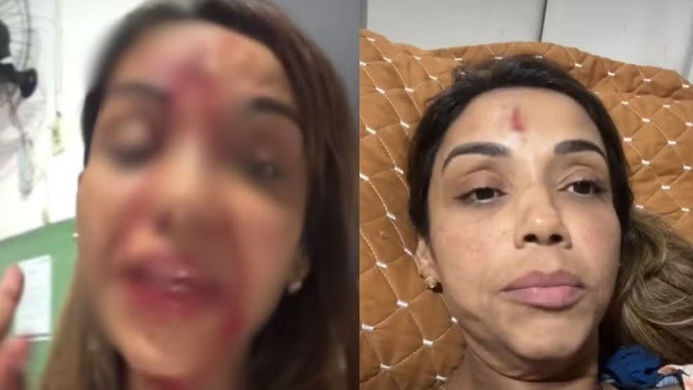 Cantora Walkíria Estarley denuncia agressão do ex durante live em Teresina