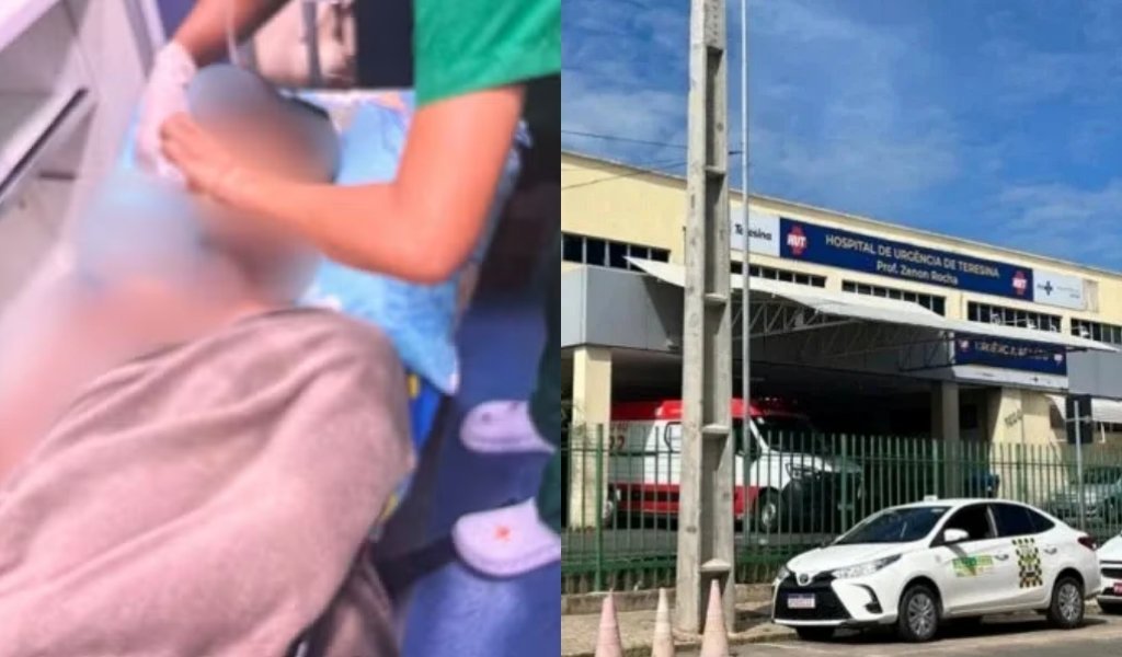 Jovem é hospitalizado após ser atacado com água fervente em Corrente, Piauí