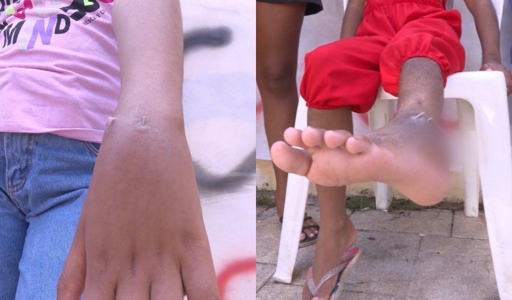 Mães reclamam de demora em cirurgias ortopédicas para crianças no Lucídio Portella