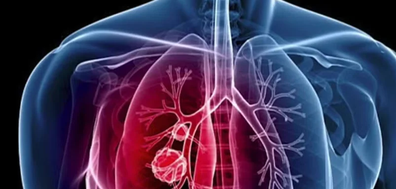 Aumento de doenças respiratórias alerta para a importância da prevenção