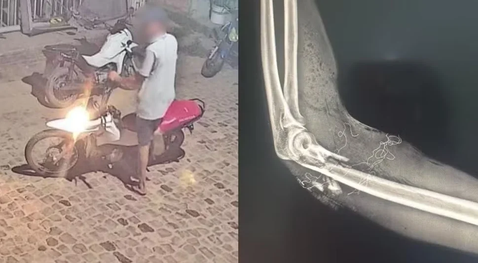 Entregador de pizza é baleado em Barras, Piauí