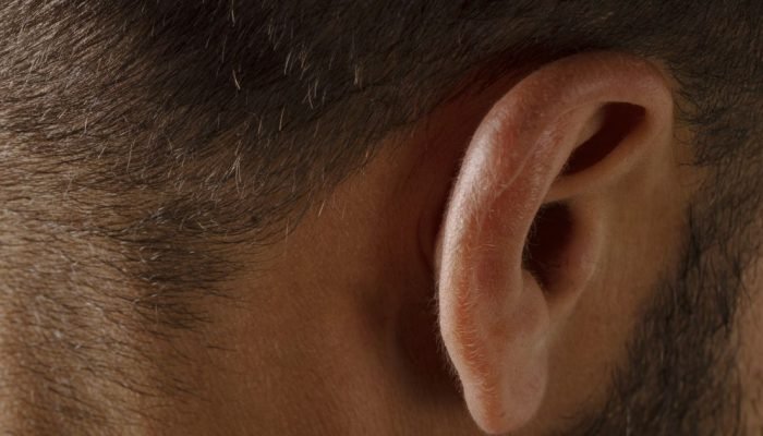 Orelha rasgada: como é feita a cirurgia corretiva e quando indicar