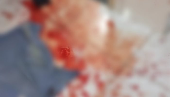 PM é baleado após ter casa invadida por criminosos que se passaram por policiais no Piauí