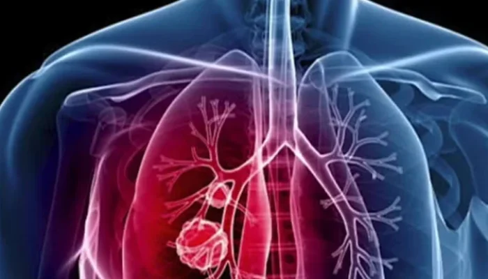 Aumento de doenças respiratórias alerta para a importância da prevenção