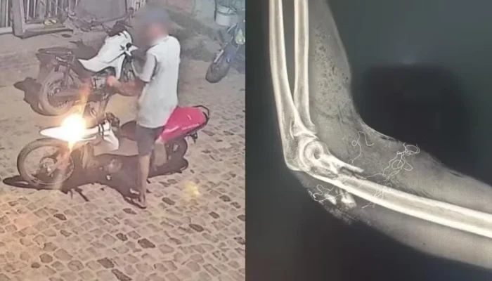 Entregador de pizza é baleado em Barras, Piauí