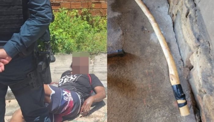 Mulher sofre fraturas após agressão brutal em Parnaíba