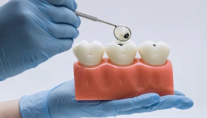 Alimentos comuns podem danificar o esmalte dos dentes; saiba mais