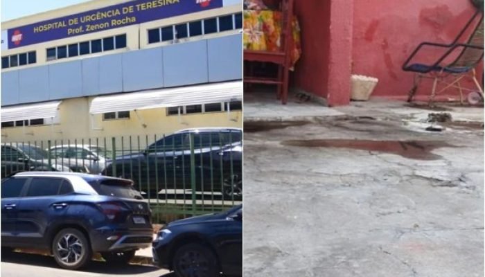Mulher que sofreu queimaduras graves morre em hospital de Teresina; mãe continua internada