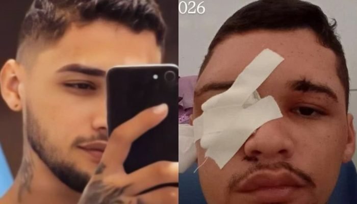 Jovem é baleado duas vezes na cabeça após confusão em Teresina