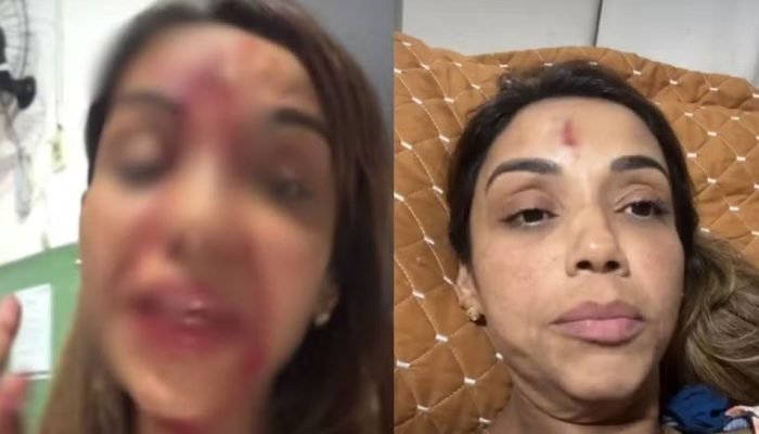 Cantora Walkíria Estarley denuncia agressão do ex durante live em Teresina