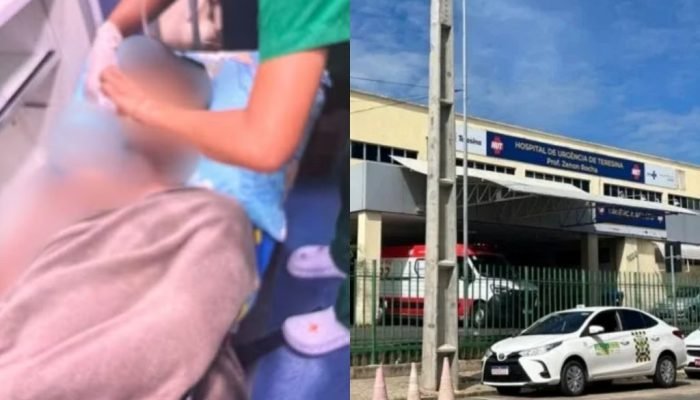 Jovem é hospitalizado após ser atacado com água fervente em Corrente, Piauí