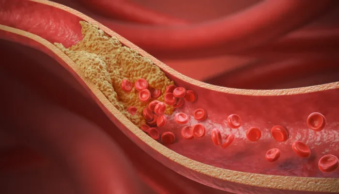 Alimentos que ajudam a reduzir o colesterol segundo cardiologistas