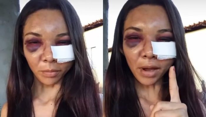 Mulher denuncia agressão do companheiro após festa em Picos