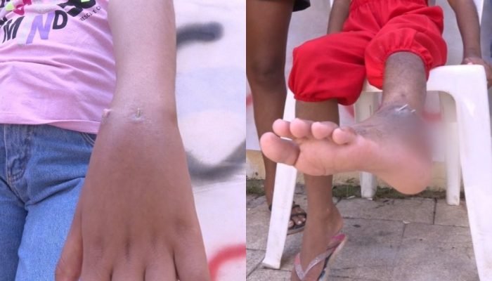 Mães reclamam de demora em cirurgias ortopédicas para crianças no Lucídio Portella