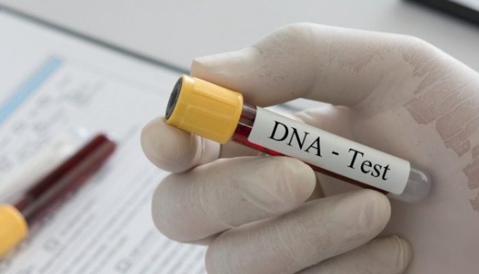 Inscrições abertas para exames de DNA gratuitos em Teresina
