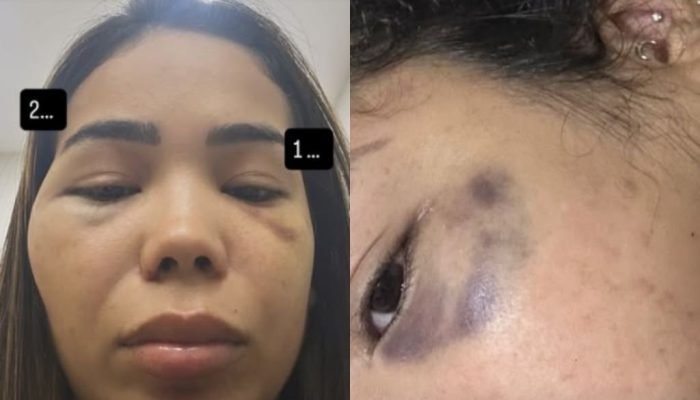 Em uma série de vídeos, Paulla revelou que esta não foi a primeira vez que sofreu violência p...